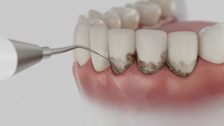 Reliable Root Canal Treatment contractor in Morgan County County, OH by Dentist Open Now